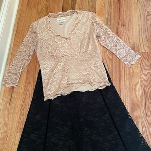 Women’s Lace Scallop Top